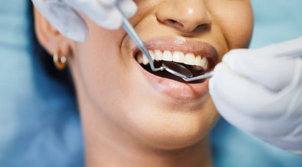 Best Broken or Cracked Tooth Emergency Dentist in Lawndale, CA